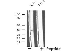 Image no. 2 for anti-Interleukin 11 Receptor, alpha (IL11RA) (C-Term) antibody (ABIN6257607)