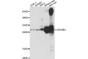 Image no. 2 for anti-Crystallin, beta B2 (CRYbB2) antibody (ABIN1876777)