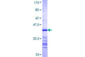 MSH4 Protein (AA 831-936) (GST tag)