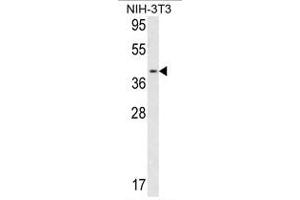 Image no. 1 for anti-Calponin 3, Acidic (CNN3) (Middle Region) antibody (ABIN452801)