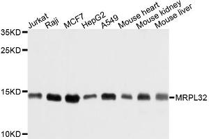 Image no. 1 for anti-Mitochondrial Ribosomal Protein L32 (MRPL32) antibody (ABIN6566738)