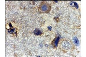 Image no. 1 for anti-Ras Homolog Enriched in Brain (RHEB) (Center) antibody (ABIN500597)