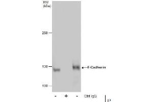 IP Image Immunoprecipitation of E-Cadherin protein from MCF-7 whole cell extracts using 5 μg of E-Cadherin antibody, Western blot analysis was performed using E-Cadherin antibody, EasyBlot anti-Rabbit IgG  was used as a secondary reagent.