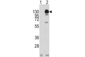 Western blot analysis of PDGFR alpha antibody and 293 cell lysate (2 ug/lane) either nontransfected (Lane 1) or transiently transfected with the human gene (2).