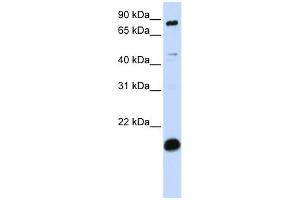 Image no. 1 for anti-SP110 Nuclear Body Protein (SP110) (C-Term) antibody (ABIN2775054)