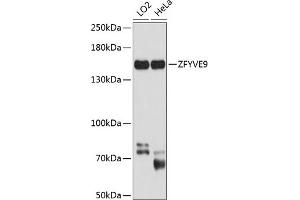 Western blot analysis of extracts of various cell lines, using ZFYVE9 antibody (ABIN6133286, ABIN6150442, ABIN6150443 and ABIN6224871) at 1:1000 dilution.