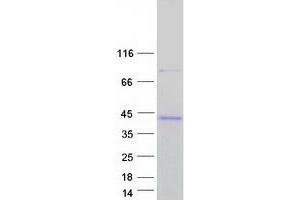 Image no. 1 for RAB34, Member RAS Oncogene Family (RAB34) (Transcript Variant 8) protein (Myc-DYKDDDDK Tag) (ABIN2730329)