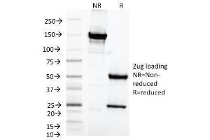 Image no. 1 for anti-Mastermind-Like 2 (MAML2) antibody (ABIN6940961)