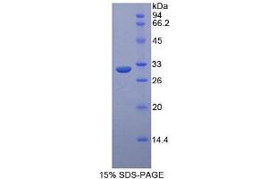 Image no. 1 for Mitogen-Activated Protein Kinase Kinase Kinase 5 (MAP3K5) protein (ABIN3008389)