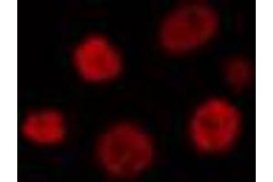 Image no. 2 for anti-Myocyte Enhancer Factor 2B (MEF2B) antibody (ABIN6259097)