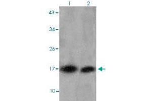 Image no. 1 for anti-Histone Cluster 1, H3d (HIST1H3D) (3meLys27) antibody (ABIN5579862)