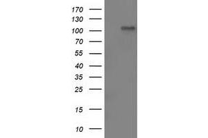 Image no. 1 for anti-LEM Domain Containing 3 (LEMD3) antibody (ABIN2724627)