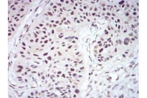 Image no. 6 for anti-Wilms Tumor 1 Associated Protein (WTAP) (AA 91-201) antibody (ABIN5542406)
