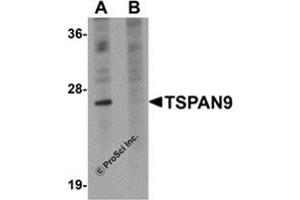 Image no. 2 for anti-Tetraspanin 9 (TSPAN9) (Center) antibody (ABIN501087)
