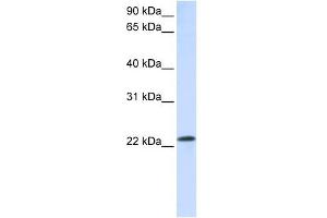 anti-RAB18, Member RAS Oncogene Family (RAB18) (C-Term) antibody