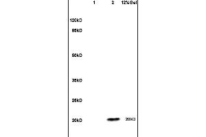 anti-Endothelial Cell-Specific Molecule 1 (ESM1) (AA 51-150) antibody