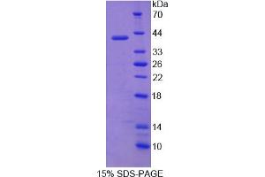Image no. 1 for Aminolevulinate Dehydratase (ALAD) (AA 1-330) protein (His tag) (ABIN6237781)