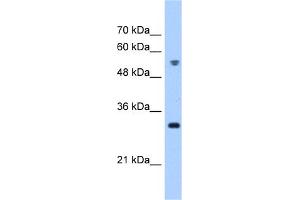Image no. 1 for anti-Tetratricopeptide Repeat Domain 5 (TTC5) (C-Term) antibody (ABIN2783601)