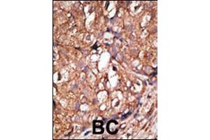 Image no. 2 for anti-5'-Nucleotidase, Ecto (CD73) (NT5E) (AA 520-550), (C-Term) antibody (ABIN388750)