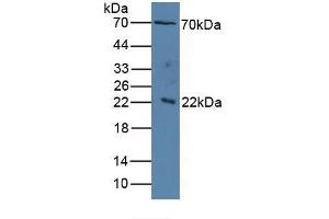 Image no. 4 for Interleukin 1 Receptor Accessory Protein (IL1RAP) ELISA Kit (ABIN6730975)