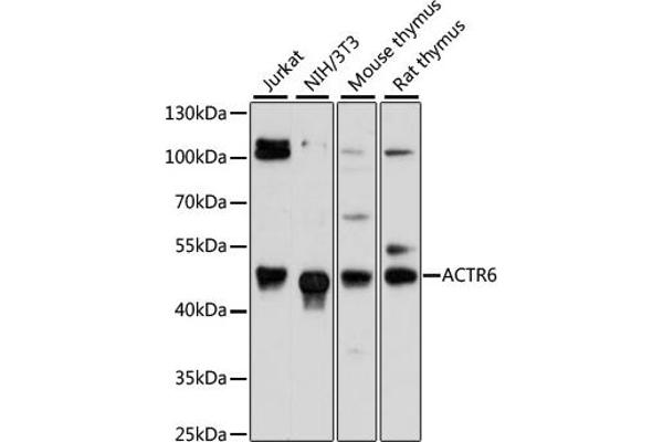 ACTR6 抗体  (AA 237-396)