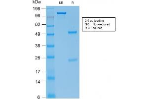 Image no. 5 for anti-Cadherin 1, Type 1, E-Cadherin (Epithelial) (CDH1) antibody (ABIN6941298)
