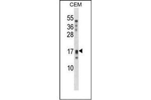 Image no. 2 for anti-Kallikrein-Related Peptidase 15 (KLK15) (AA 79-106), (Middle Region) antibody (ABIN953102)