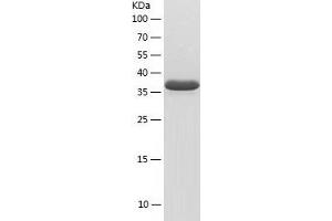 SAMSN1 Protein (AA 1-373) (His tag)