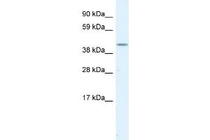 Image no. 3 for anti-serpin Peptidase Inhibitor, Clade H (Heat Shock Protein 47), Member 1, (Collagen Binding Protein 1) (SERPINH1) (C-Term) antibody (ABIN2792207)