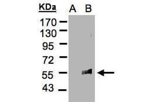 Image no. 1 for anti-Feline Leukemia Virus Subgroup C Cellular Receptor 1 (FLVCR1) (C-Term) antibody (ABIN2856387)