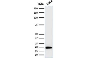 Image no. 4 for anti-Ferritin, Light Polypeptide (FTL) (AA 38-165) antibody (ABIN6939458)