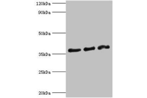 DFFA anticorps  (AA 1-331)