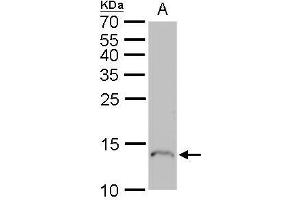 WB Image Profilin 1 antibody detects Profilin 1 protein by Western blot analysis.