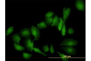 LGALS1/Galectin 1 anticorps  (AA 1-135)