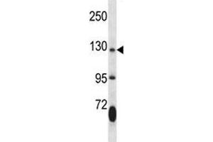 Image no. 2 for anti-Janus Kinase 2 (JAK2) (AA 666-694) antibody (ABIN3031509)