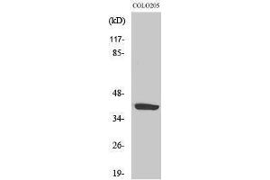 Image no. 1 for anti-Cysteinyl Leukotriene Receptor 1 (CYSLTR1) (Internal Region) antibody (ABIN3184208)