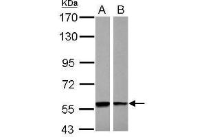 Image no. 2 for anti-phosphoglycerate Dehydrogenase (PHGDH) (Internal Region) antibody (ABIN2855238)