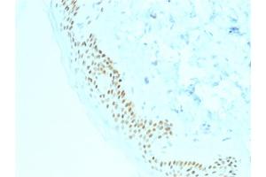 Image no. 3 for anti-Tumor Protein P63 (TP63) antibody (ABIN6940967)