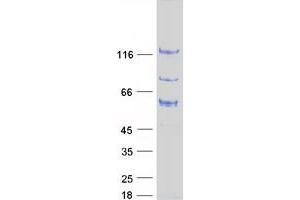 Image no. 1 for rho GTPase Activating Protein 17 (ARHGAP17) (Transcript Variant 1) protein (Myc-DYKDDDDK Tag) (ABIN2714873)