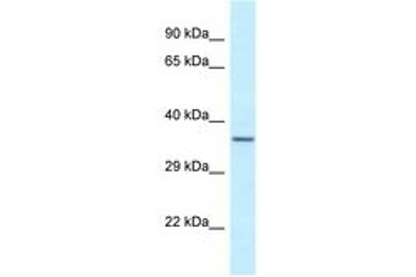 EXOSC9 antibody  (N-Term)