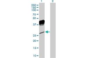 Image no. 1 for anti-Killer Cell Lectin-Like Receptor Subfamily C, Member 1 (KLRC1) (AA 1-233) antibody (ABIN517356)