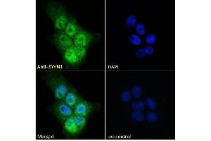 Image no. 4 for anti-Synovial Apoptosis Inhibitor 1, Synoviolin (SYVN1) (Internal Region) antibody (ABIN1590085)