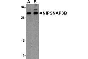 NIPSNAP3B antibody  (Middle Region)