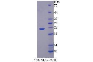 Image no. 1 for phospholipid Scramblase 3 (PLSCR3) (AA 99-253) protein (His tag) (ABIN6239436)