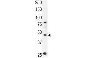 Image no. 2 for anti-Chemokine Binding Protein 2 (CCBP2) (N-Term) antibody (ABIN357385)