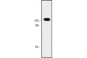 Image no. 1 for anti-Galactosidase, beta 1 (GLB1) antibody (ABIN93909)