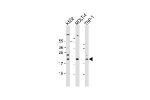 Image no. 4 for anti-Allograft Inflammatory Factor 1 (AIF1) (AA 6-36), (N-Term) antibody (ABIN654407)
