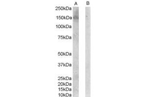 Image no. 2 for anti-Receptor Tyrosine-Protein Kinase ErbB-3 (ERBB3) (C-Term) antibody (ABIN185461)