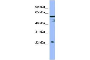 Image no. 2 for anti-Fas Apoptotic Inhibitory Molecule (FAIM) (Middle Region) antibody (ABIN2786592)