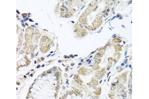 Immunohistochemistry of paraffin-embedded Human stomach using IFNL3 Polyclonal Antibody at dilution of 1:100 (40x lens).